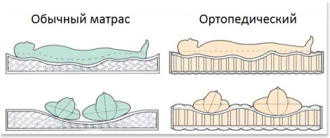 Différences entre les matelas