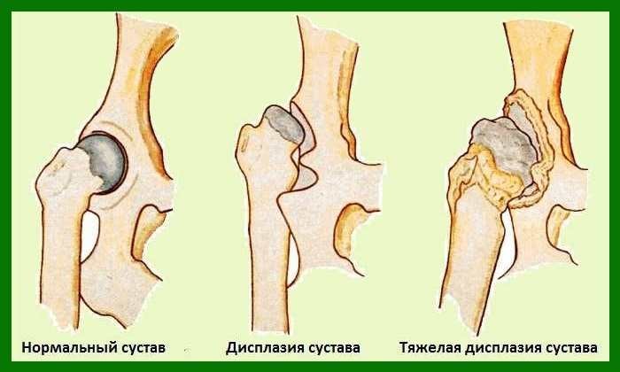 Indicazioni per l'uso della stecca Frejka